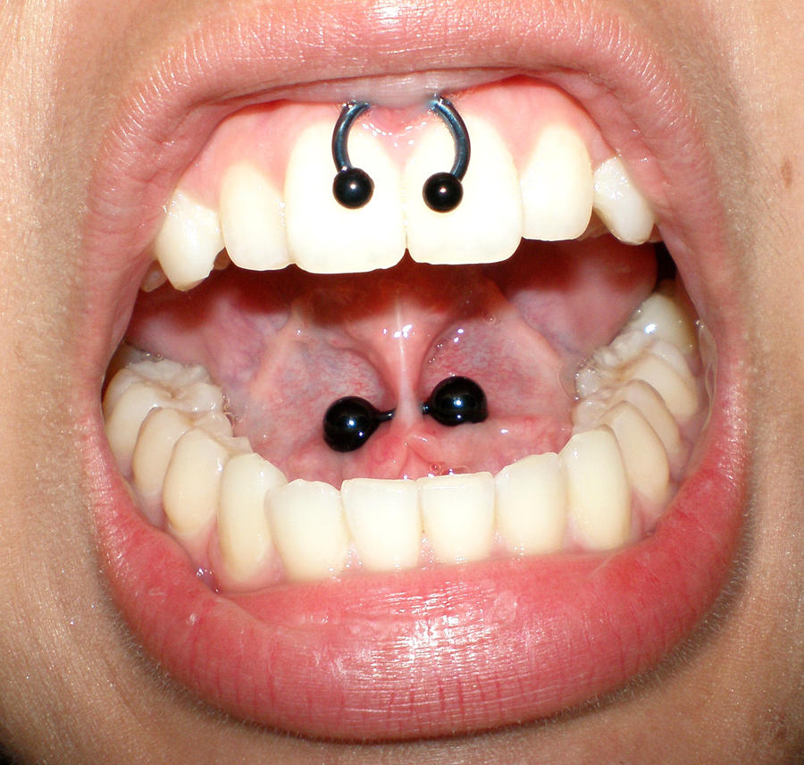 what is a smiley piercing. Bottom Scrumper Piercing by
